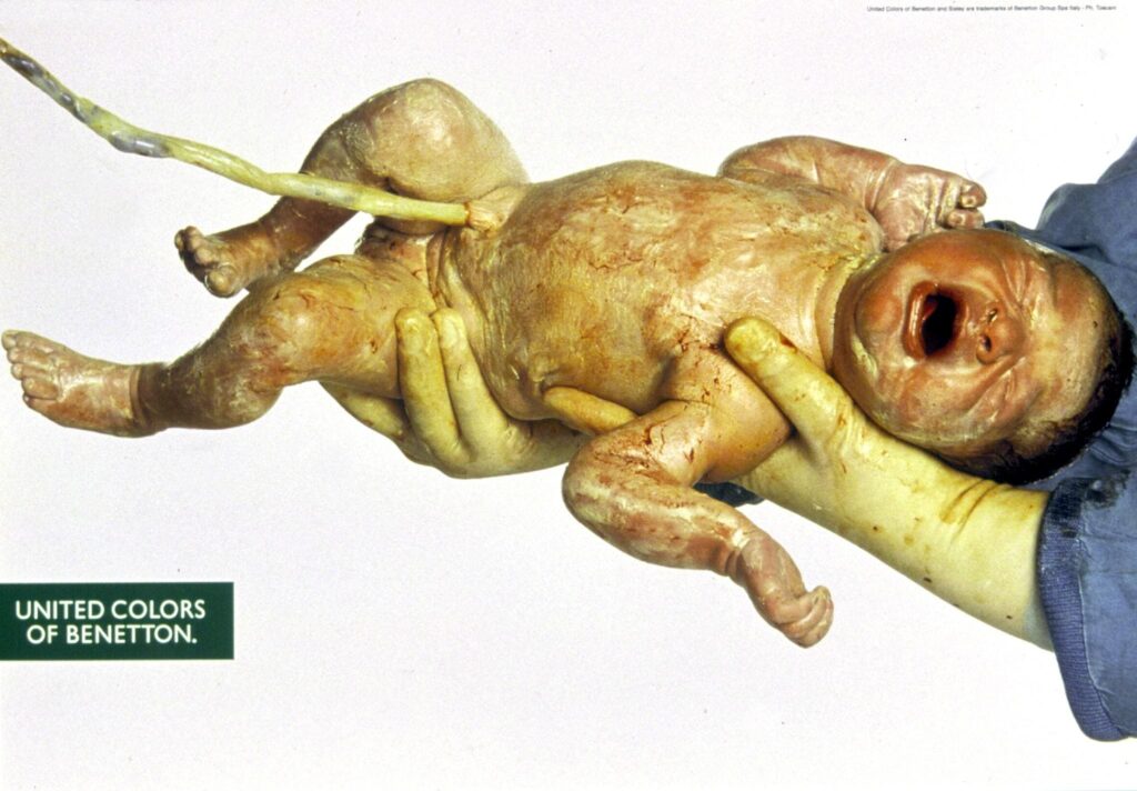 Dieses provokante Bild zeigt ein Neugeborenes unmittelbar nach der Geburt, noch verbunden durch die Nabelschnur – ein Symbol für das Leben, die Verbundenheit und den Ursprung des Menschen. Toscani wollte damit die Unschuld und Gleichheit aller Menschen von Anfang an betonen, unabhängig von Herkunft, Hautfarbe oder sozialem Status.
Bild: Benetton-Group